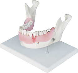 DENTAL DISEASE ANATOMY