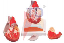 human heart on diaphragm