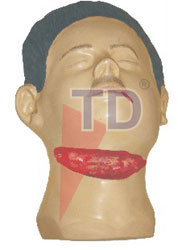 suicidal wounds of throat