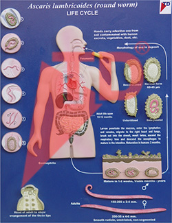 ascaris-lumbricoides